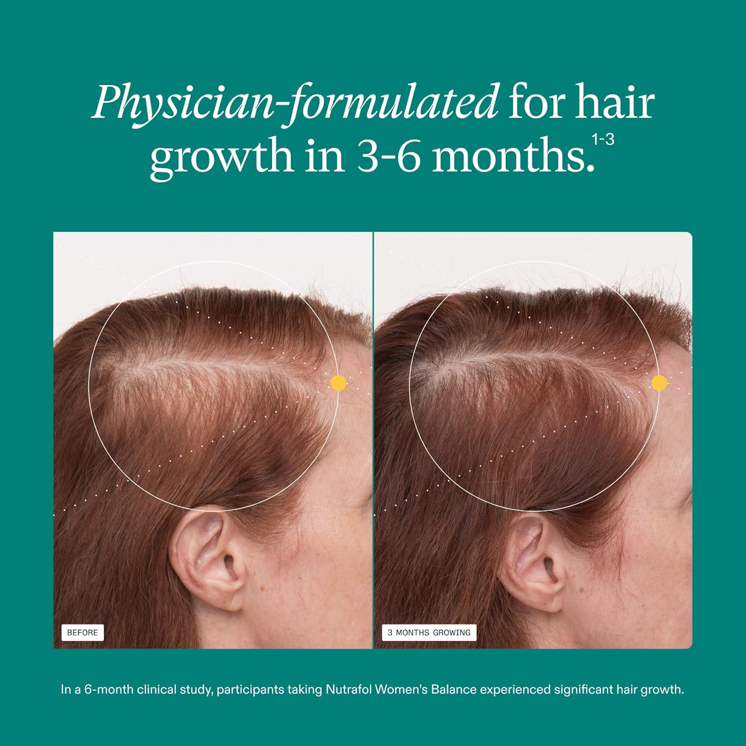 Nutrafol Women's Balance Hair Growth Supplements, Ages 45 and Up, Clinically Tested for Visibly Thicker Hair and Scalp Coverage, Dermatologist Recommended - 1 Month Supply - Image 4