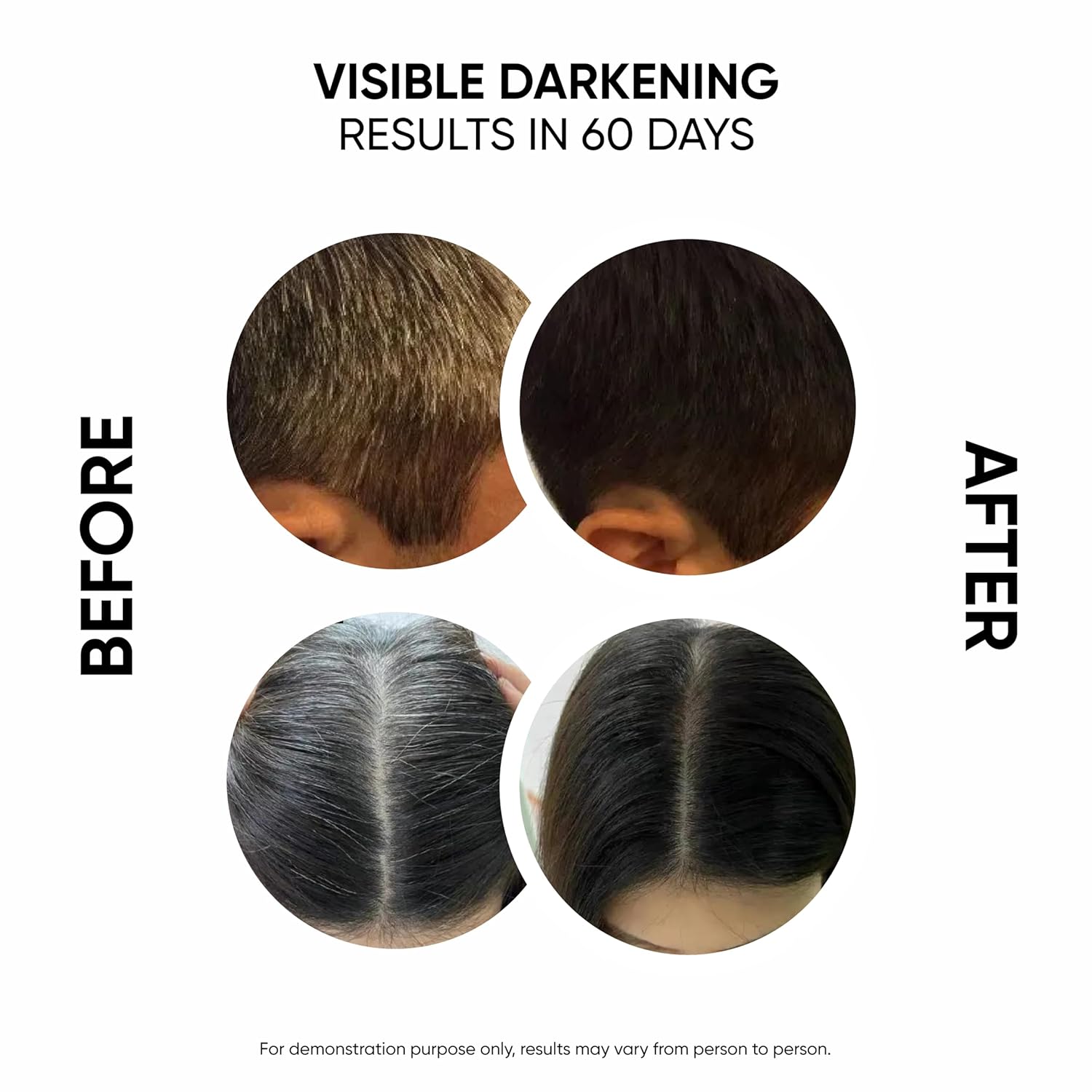 Masofta Anti Gray Hair Darkening Serum | Reverses & Limits Hair & Beard Graying with Arcolys, Melano Gray, for Promoting Darker, Shinier Hair and Beard, For Both Men & Women, 1.01 fl.oz./30 ml - Image 3