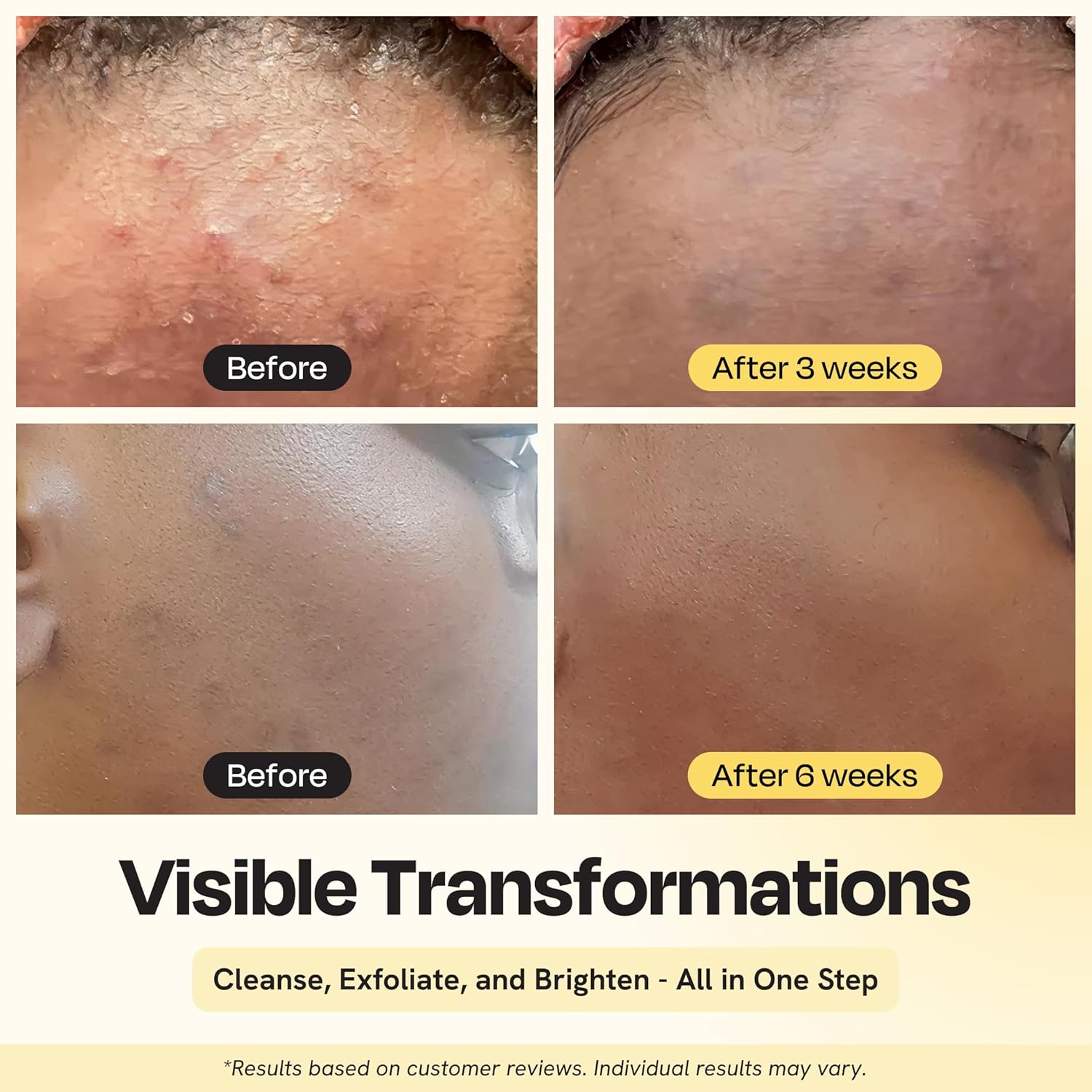 Gleamin Clarifying Brightening Cleanser - 2% Salicylic Acid with Vitamin C Facial Cleanser, PHA & AHA, Unclogs Pores, Gently Exfoliates for All Skin Types, Fragrance Free - 3.4 fl oz - Image 2